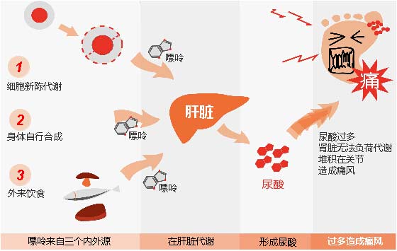 貴陽(yáng)強(qiáng)直醫(yī)院痛風(fēng)形成原理.jpg